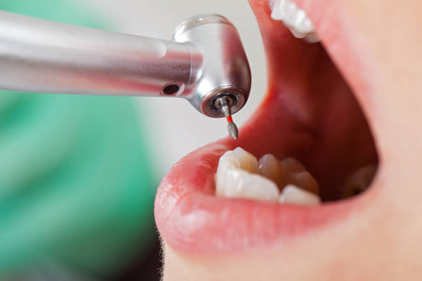 Best Orthodontic Emergency Dentist in Summerville, SC